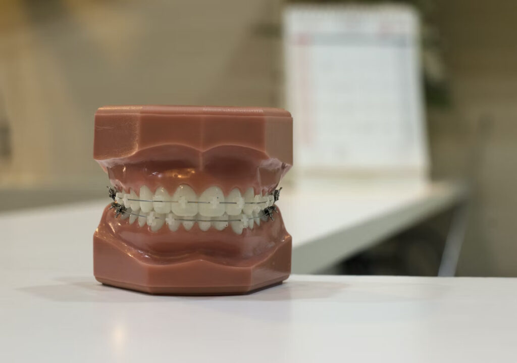 a full set of dental model teeth place on top of a counter